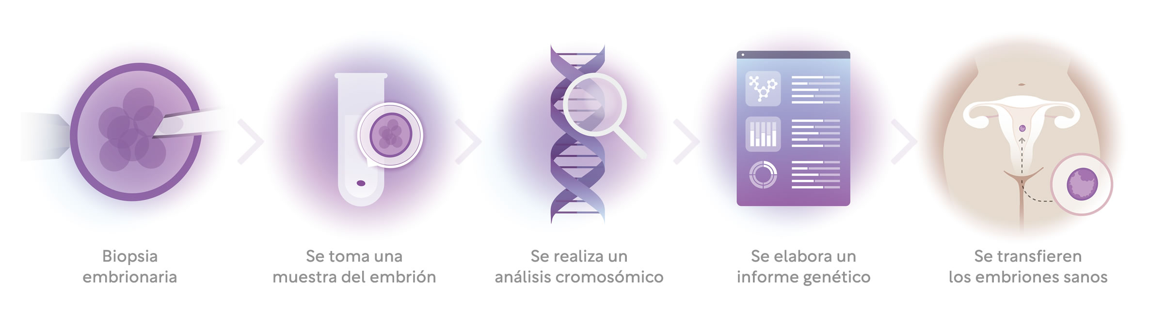 Infografía de cómo se realiza el Test Genético Preimplantacional: Primero se realiza una biopsia embrinal, luego se coge una muestra del embrión y se efectúa un análisis cromosómico. Posteriormente se elabora un reporte genético y se transfiere el embrión sano.