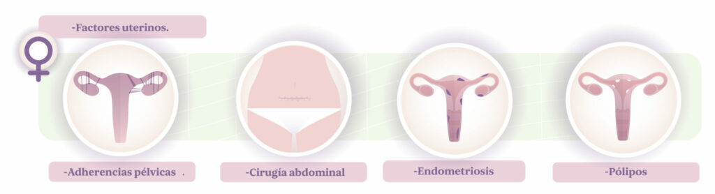 factores uterinos infertilidad secundaria