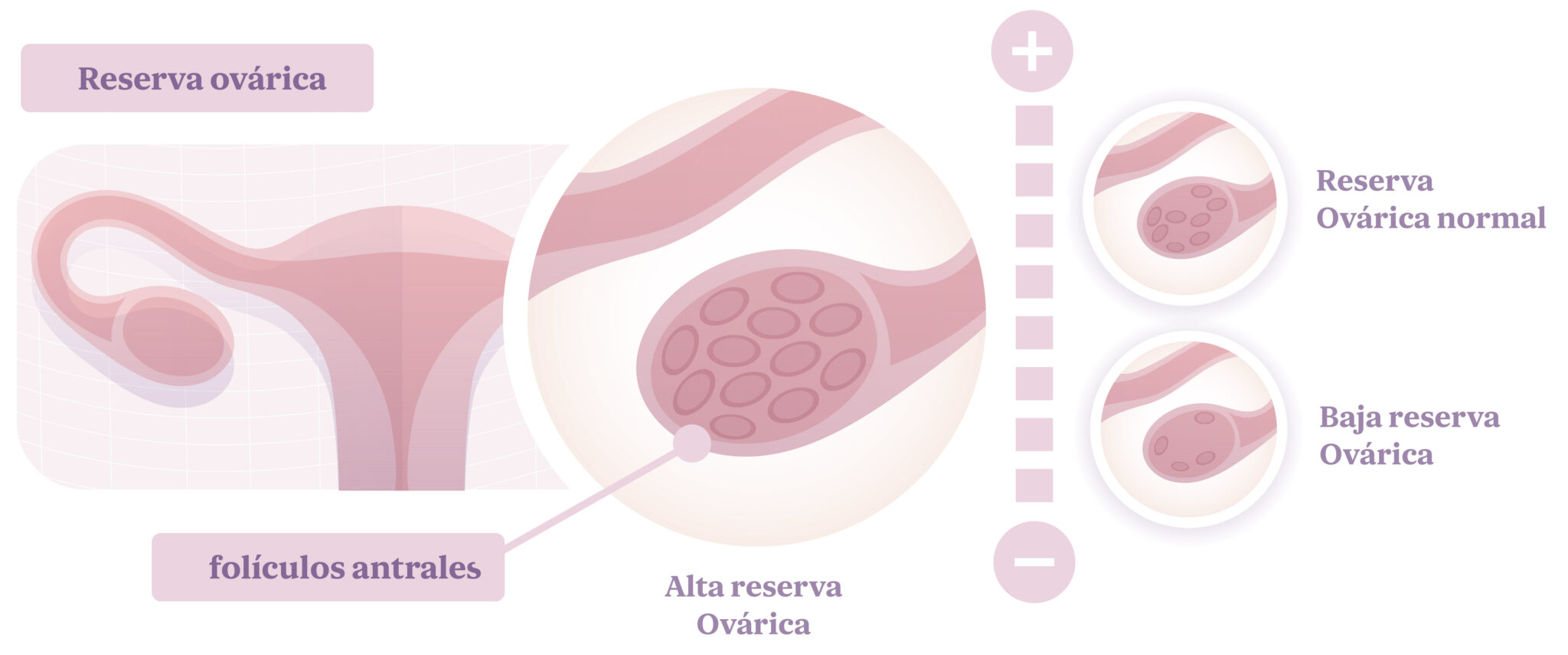 Reserva ovárica qué es y cómo conocerla Next Fertility