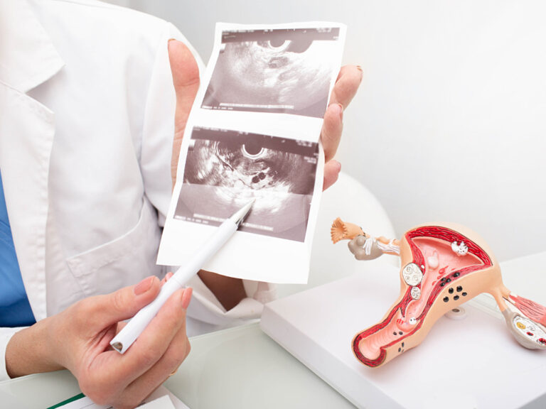 médico mostrando una ecografía de un embarazo tras una ligadura de trompas