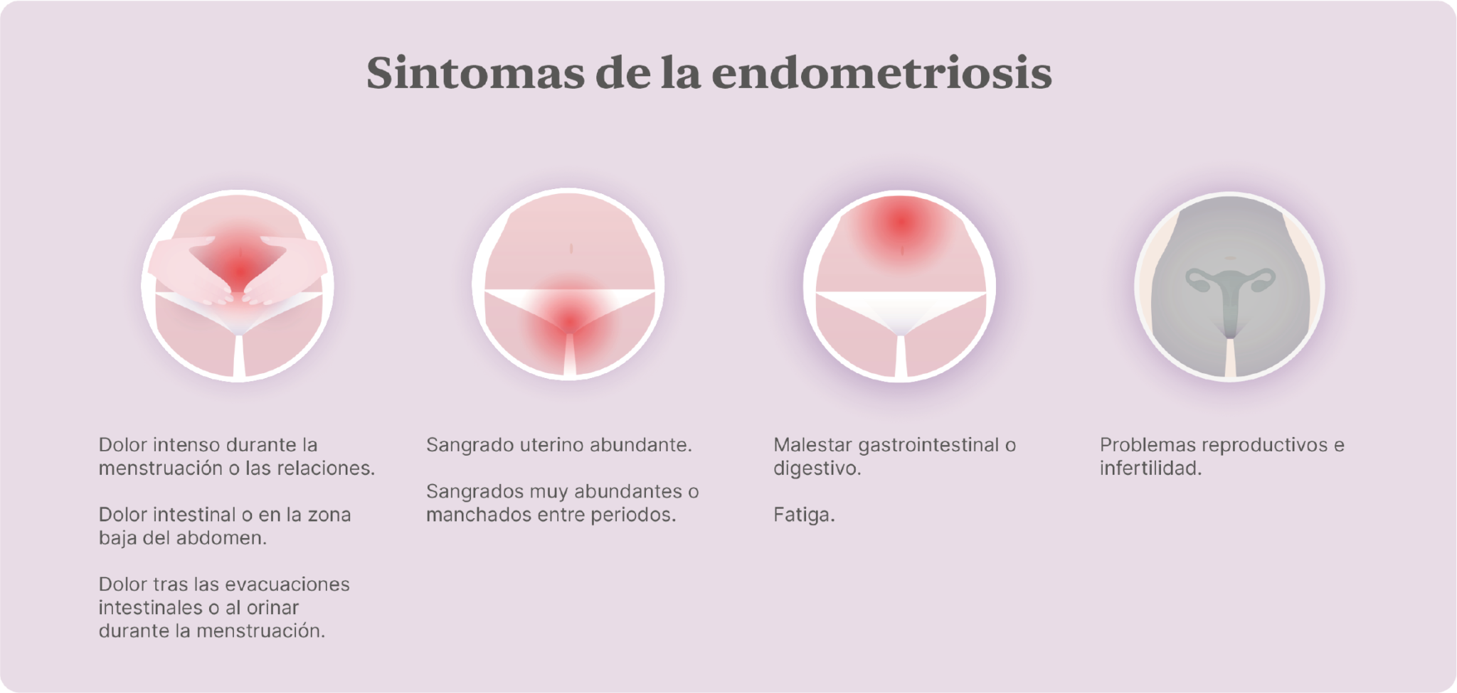 Endometriosis Claves Para Entender La Enfermedad Next Fertility 4276