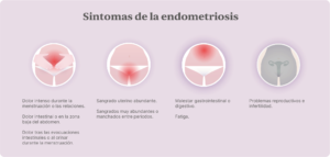 Sintomas de la endometriosis