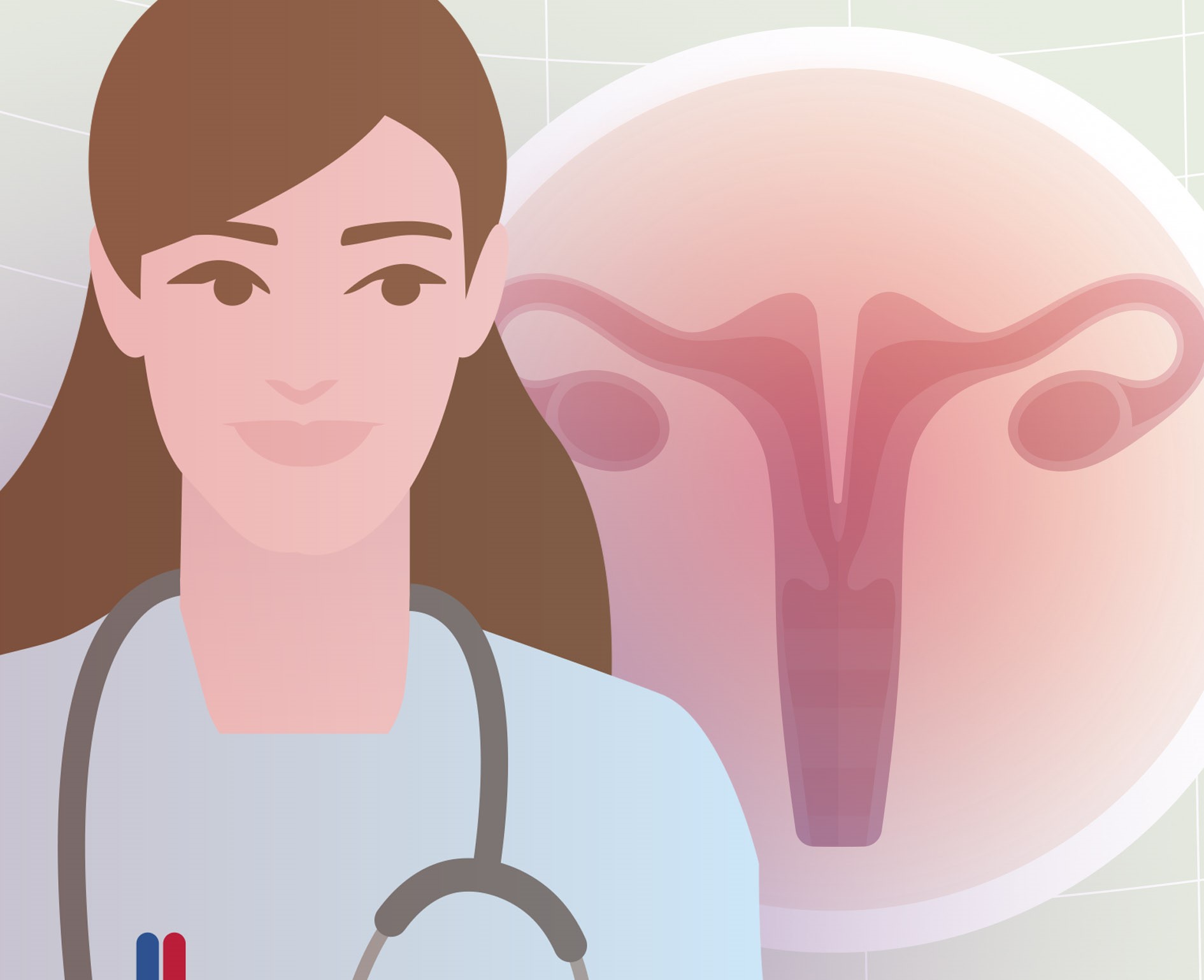 ¿qué Es Un útero Bicorne Y Cómo Afecta Al Embarazo Next Fertilityemk 4977