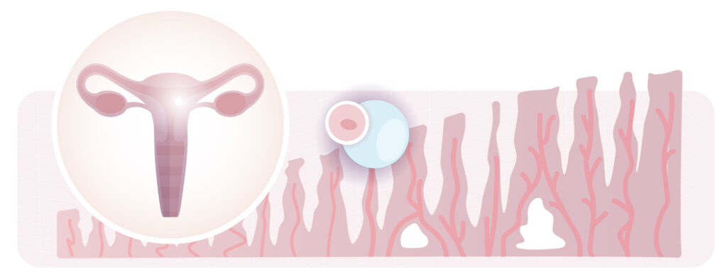 implantación embrionaria