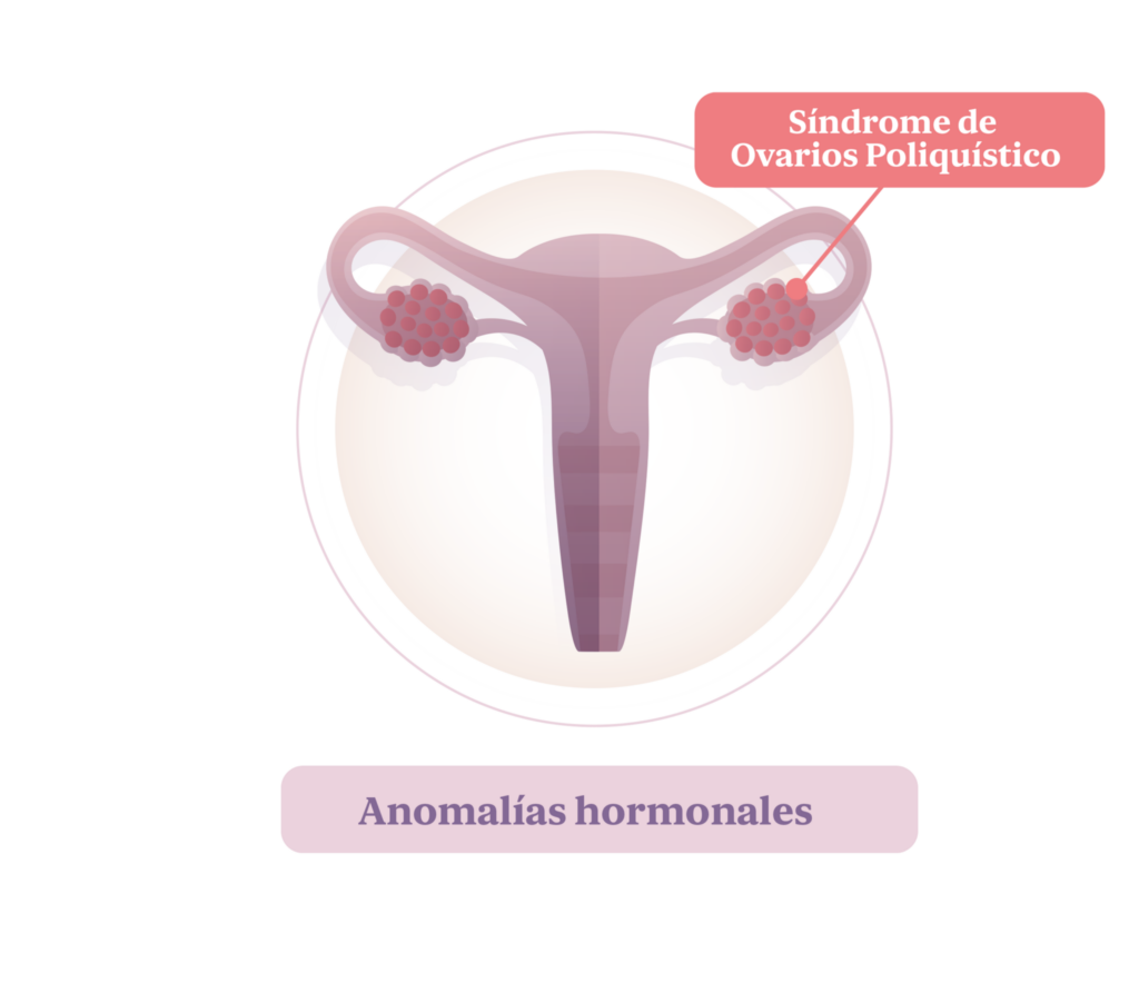 Aborto. Desequilibro hormonal.