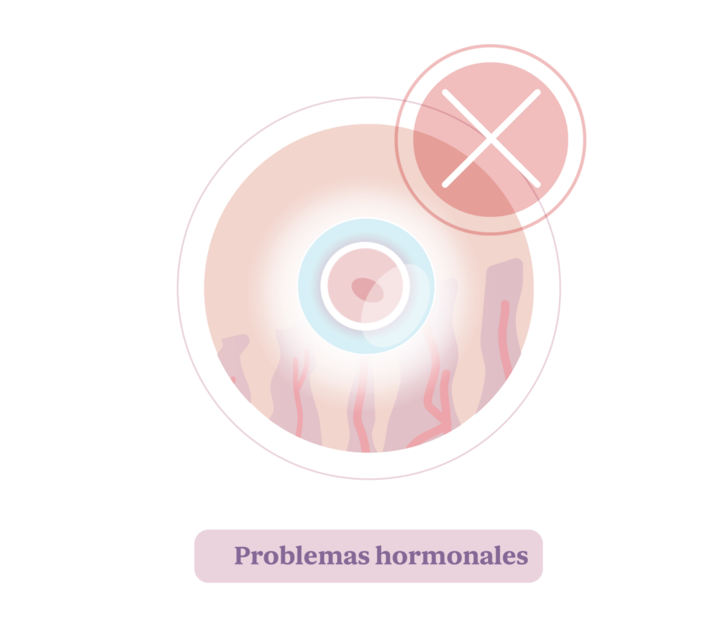 Aborto. Problemas hormonales