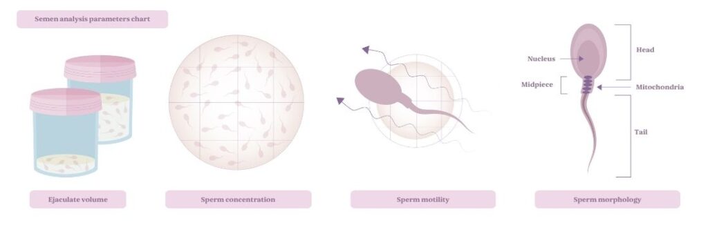Semen analysis