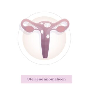 Miskraam. Uteriene afwijkingen.