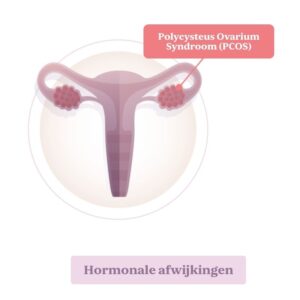 Miskraam. Hormonale disbalans.