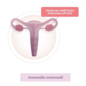 Aborto. Squilibrio ormonale
