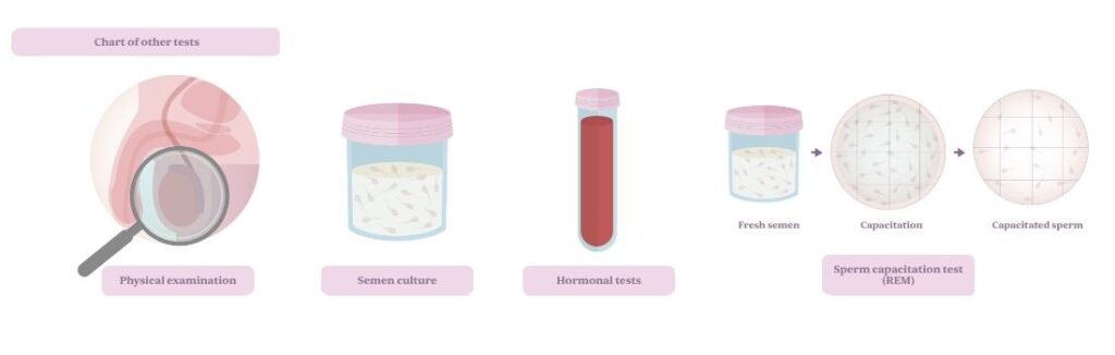Male infertility tests
