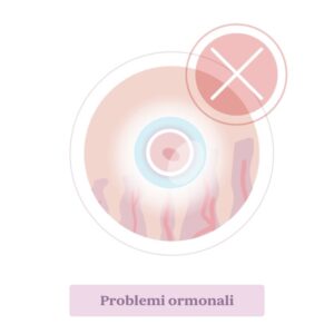 Aborto. Problemi ormonali