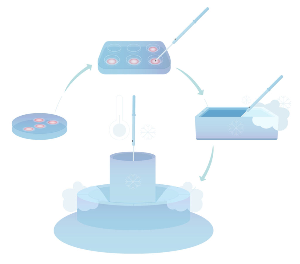 Proceso de congelación de óvulos